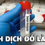Tinh dịch đồ là gì