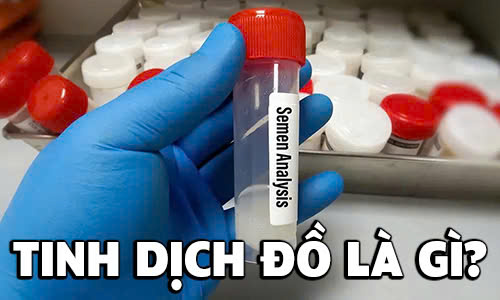 Tinh dịch đồ là gì